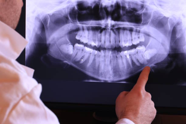 Best Dental Abscess Treatment in Air Force Academy, CO